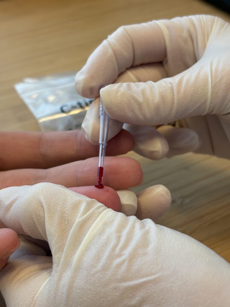 Bild einer Testung mit Blutabnahme an einem Finger