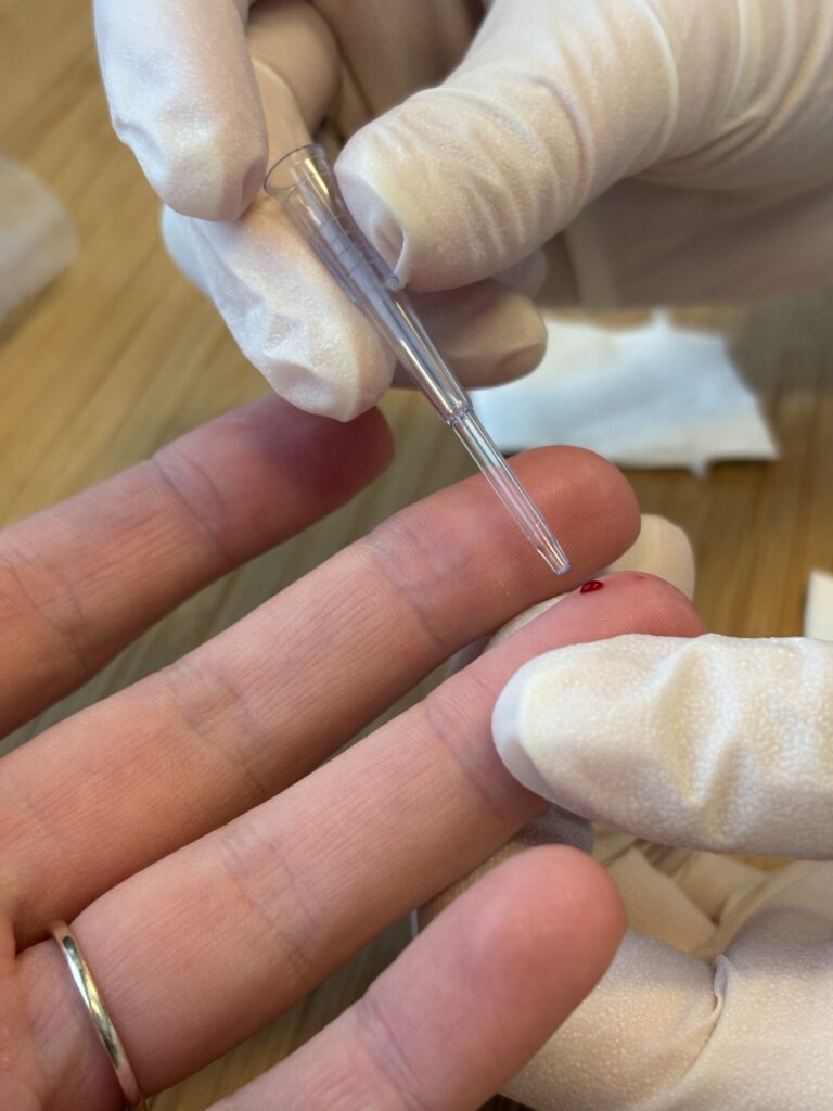 Bild einer Blutabnahme am Finger